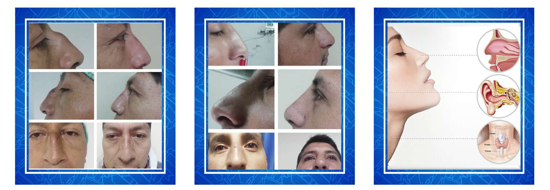 francisco macas